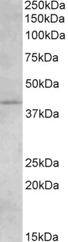 IFT88 Antibody