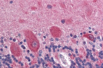 GAD2 Antibody