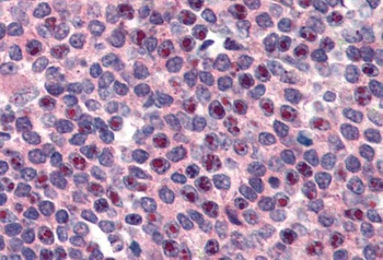 FANCG Antibody