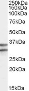 EGR2 Antibody