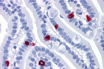 CTSK Antibody