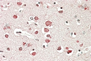 BGN Antibody
