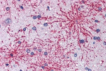 BAIAP2 Antibody