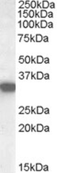 ARSB Antibody