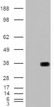 ARSB Antibody