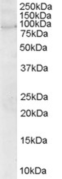 ARHGEF4 Antibody