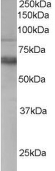 ANTXR1 Antibody
