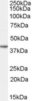 Vitamin D Receptor Antibody