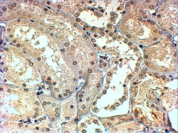 TBL1X/TBL1XR1 Antibody