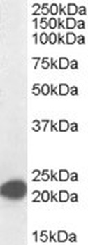 MAX Antibody