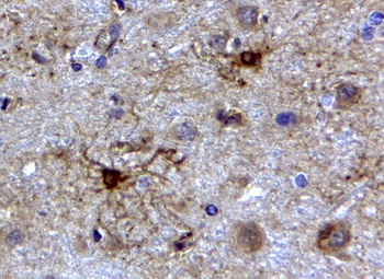 GFAP Antibody