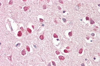 BAIAP2 Antibody