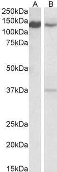TICAM-1/TRIF Antibody
