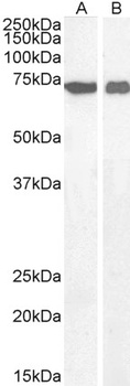ASIC1 Antibody
