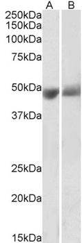 IL-1 beta Antibody