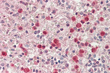 HNRNPA2B1 Antibody