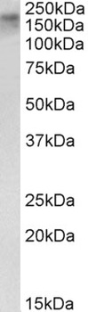 TGM2 Antibody
