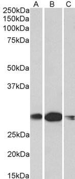 CREB3L2 Antibody
