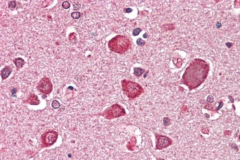 FURIN/PCSK3 Antibody