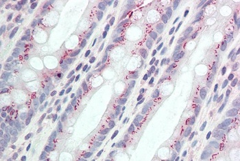 MDH1/MOR2 Antibody