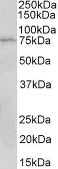 MAPKAPK2 Antibody