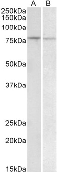 MAPKAPK2 Antibody