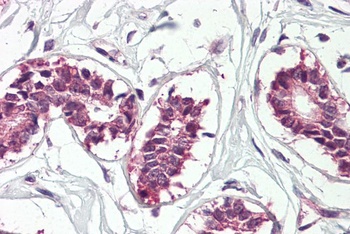 BDNF Antibody