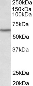 TBP Antibody