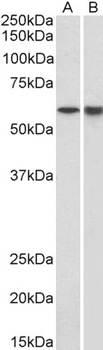 TBP Antibody