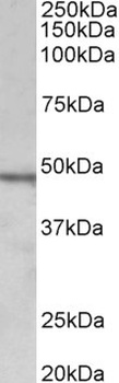 Zcchc11 Antibody