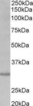 Zcchc11 Antibody