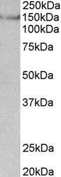 TGM2 Antibody
