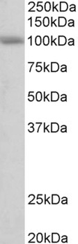 Hsd11b1 Antibody