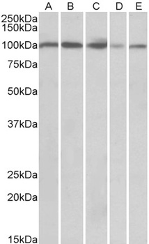 Hsd11b1 Antibody