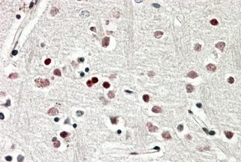ATXN2 Antibody