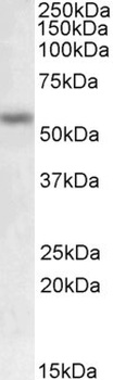GHITM Antibody