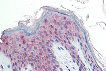 MOBKL3 Antibody