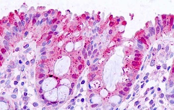 TP63 Antibody