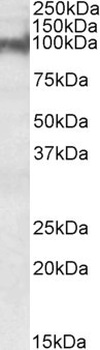 NDRG2 Antibody