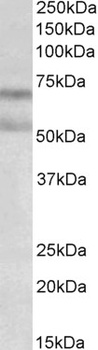 IL7R Antibody