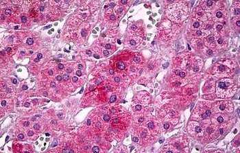 GHITM Antibody