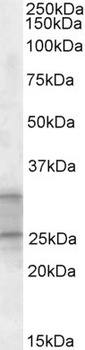 KCNN2 Antibody