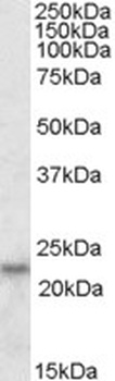 VDBP Antibody