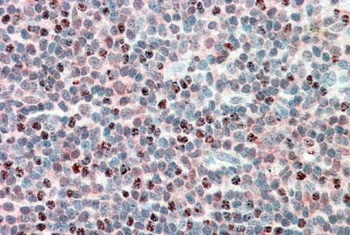 IL17RA Antibody