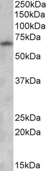 RCBTB2 Antibody