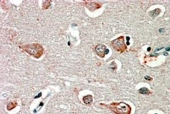 TNKS2 Antibody