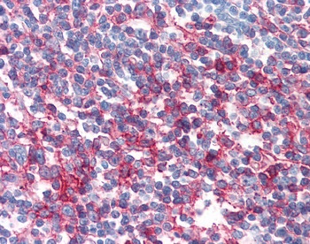 FAS Antibody
