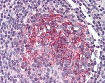 IL1R2 Antibody