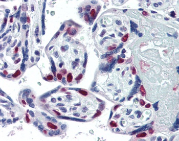 PARP1 Antibody