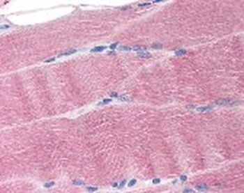 SLC40A1 Antibody